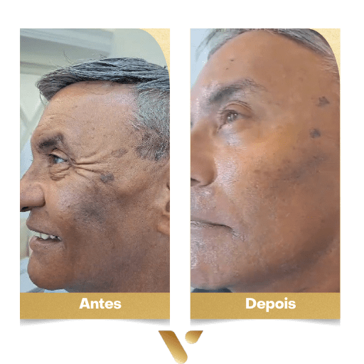 Estética facial, botox, limpeza de pele, cidade nova belo horizonte