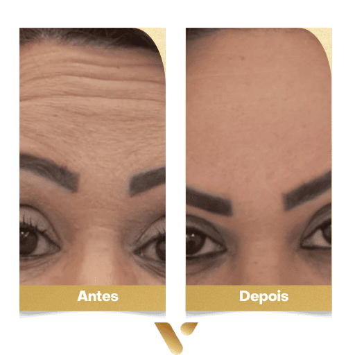 Estética facial, botox, limpeza de pele, cidade nova belo horizonte