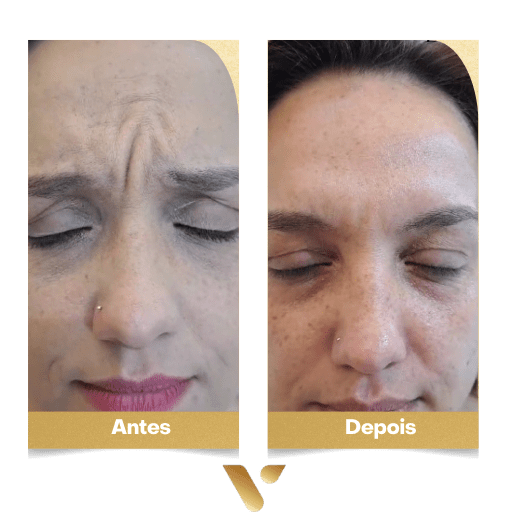 Estética facial, botox, limpeza de pele, cidade nova belo horizonte