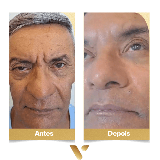 Estética facial, botox, limpeza de pele, cidade nova belo horizonte