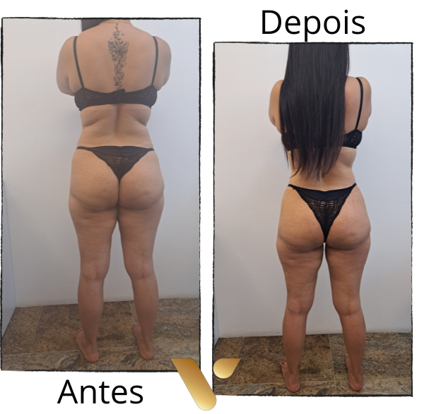 SlimDetox cidade nova reducao de medidas abdominais