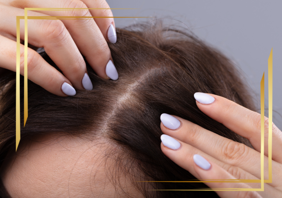 Cabelo Ralo e Fino como tratar, cidade nova belo horizonte