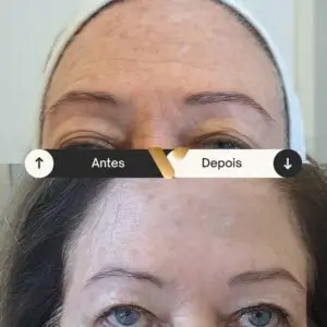 BOTOX-CIDADE NOVA- BELO HORIZONTE