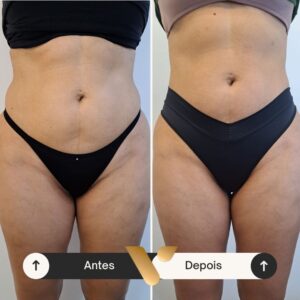 Resultados corporais via beauty estetica, cidade nova bh