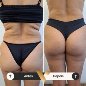 Resultados corporais via beauty estetica, cidade nova bh