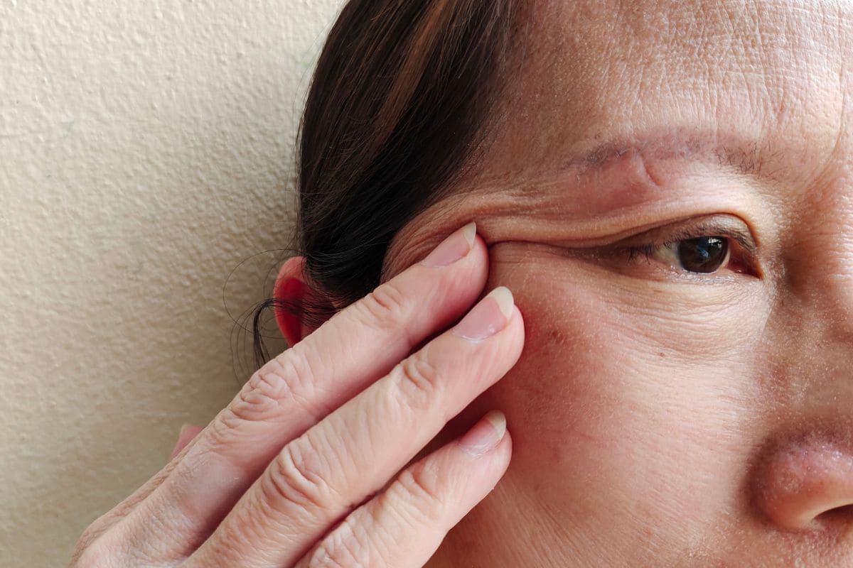 Flacidez após emagrecimento