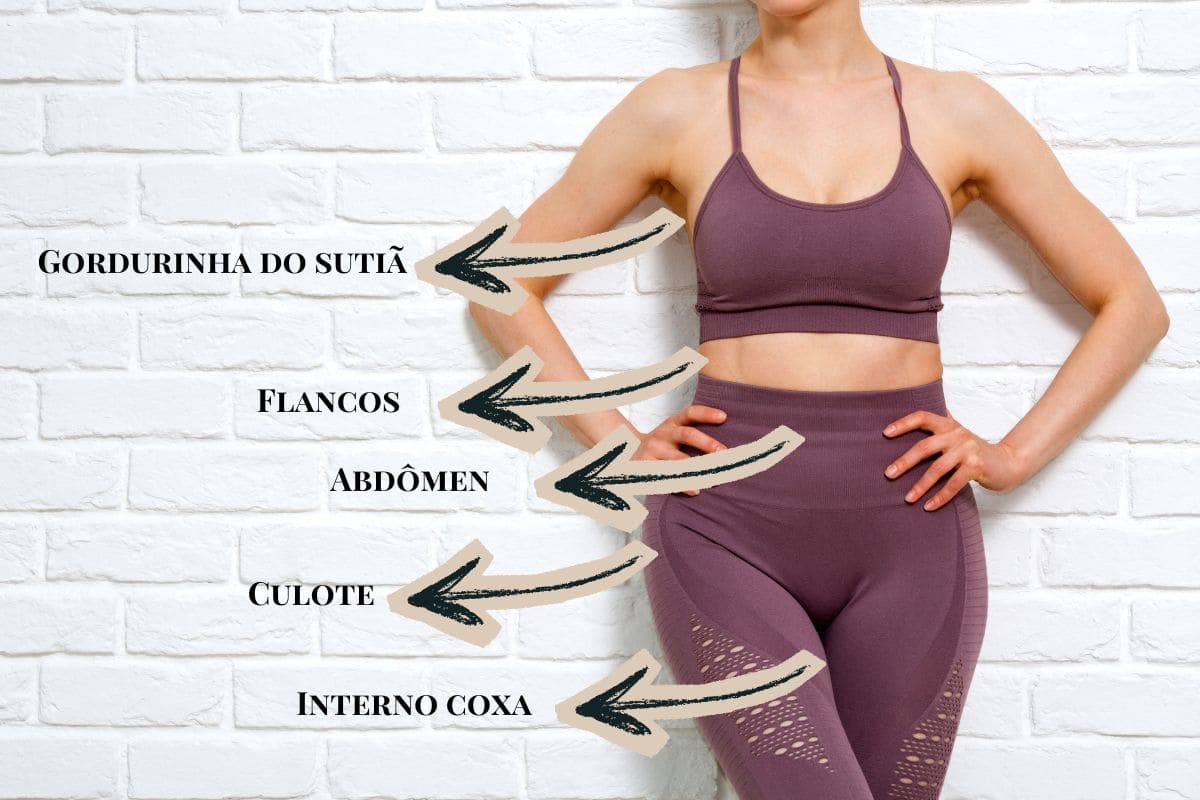 *Áreas do corpo que respondem bem a criolipólise