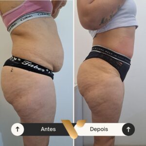 Resultados corporais via beauty estetica, cidade nova bh