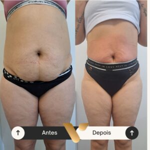 Resultados corporais via beauty estetica, cidade nova bh