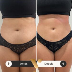 Resultados corporais via beauty estetica, cidade nova bh