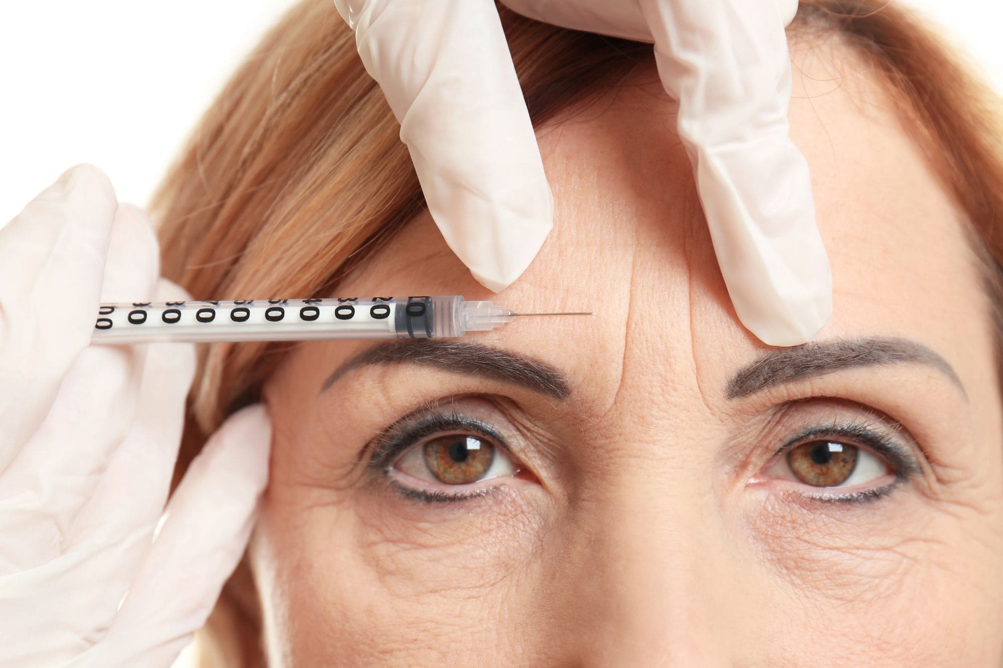 Botox: Por Que Muitas Pessoas Fazem e Ninguém Percebe